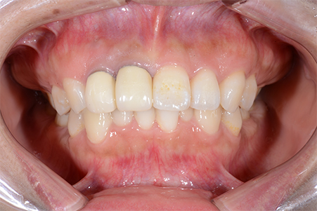 どんな原因があるの?