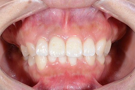 どんな原因があるの?